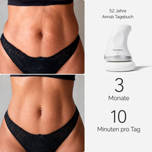 Lade das Bild in den Galerie-Viewer, Formkur - Anti-Cellulite Massagegerät für Bauch, Beine & Po