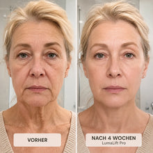 Lade das Bild in den Galerie-Viewer, LumaLift Pro – 3-in-1 Straffungs- & Massagegerät für Gesicht, Arme & Körper