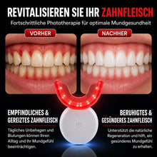 Lade das Bild in den Galerie-Viewer, Zahnfleischvital Pro
