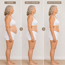 Lade das Bild in den Galerie-Viewer, Formkur - Anti-Cellulite- & Bindegewebs-Massagegerät