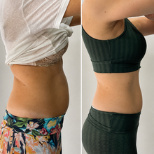 Lade das Bild in den Galerie-Viewer, Formkur - Anti-Cellulite Massagegerät für Bauch, Beine &amp; Po